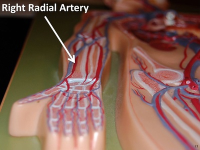 Radial artery