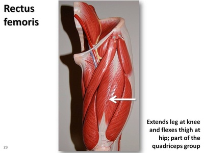 Rectus femoris