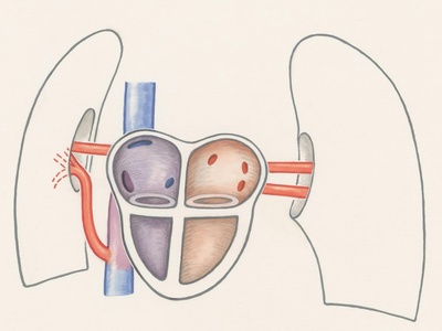 Short gastric arteries