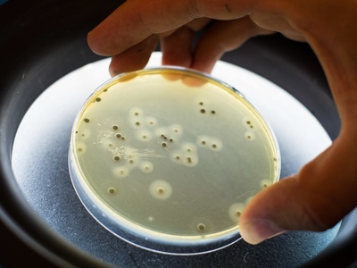 Staphylococcus aureus