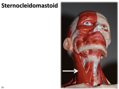 Sternocleidomastoid