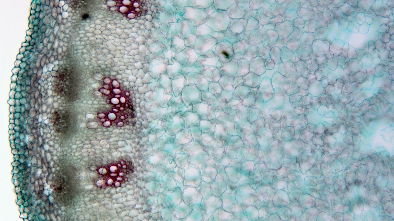 Microscopic views comparing plant cell walls and animal cell membranes