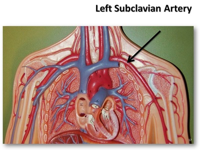 Subclavian artery