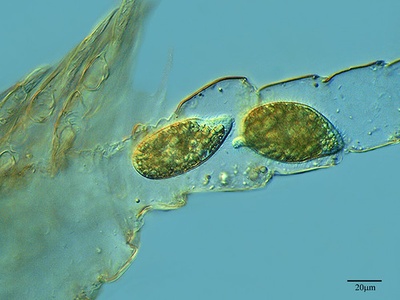 Tetrahymena