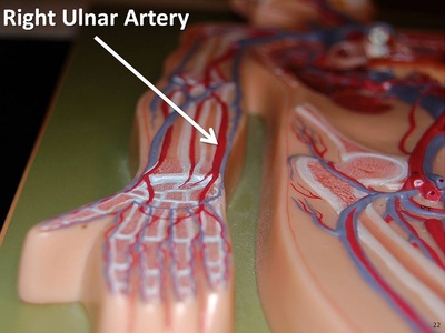 Ulnar artery