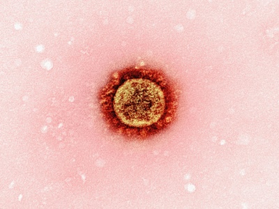 Viral meningitis (enteroviral)