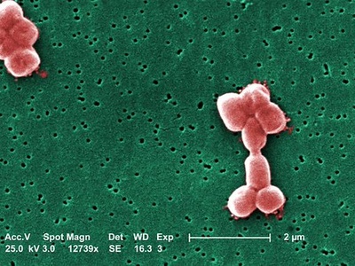 Acinetobacter baumannii
