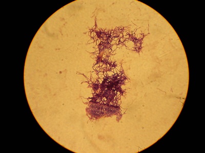 Actinomyces israelii