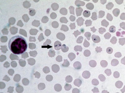 Babesia
