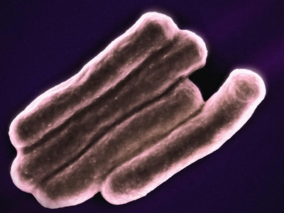 Bacillus anthracis