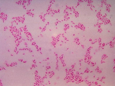 Bacteroides fragilis