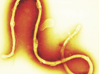 Borrelia burgdorferi