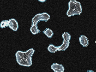 Ciliate (Paramecium)