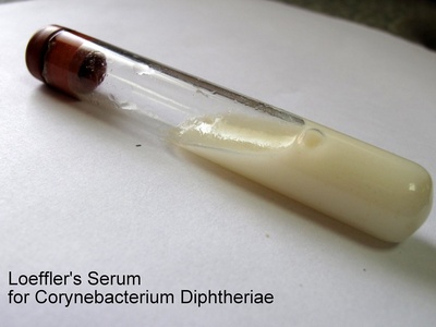 Corynebacterium diphtheriae