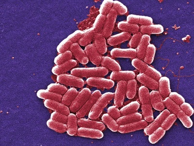 E. coli O157:H7