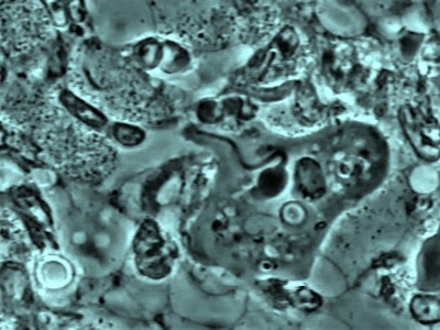 Entamoeba (pathogen)
