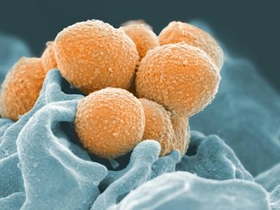 Enterococcus faecalis