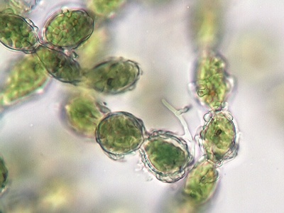 -green algal filament