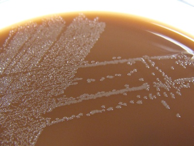 Haemophilus influenzae