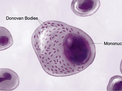 Klebsiella granulomatis