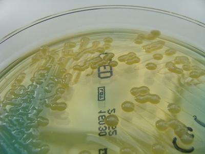Klebsiella pneumoniae