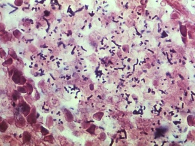 Listeria monocytogenes