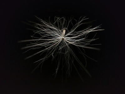 Medium spiny neuron