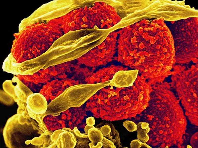 List of Pathogenic Bacteria - 33Science