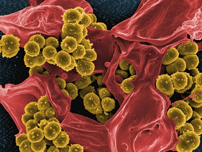 Non-typhoidal Salmonella
