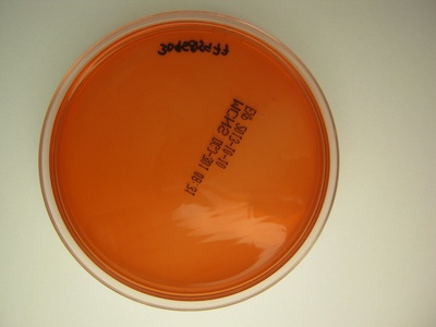 Pasteurella multocida