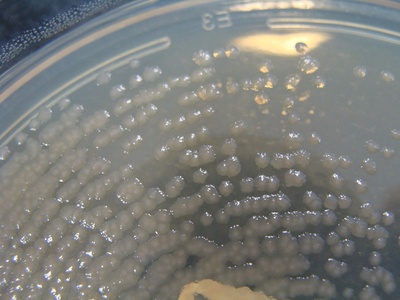Pseudomonas aeruginosa
