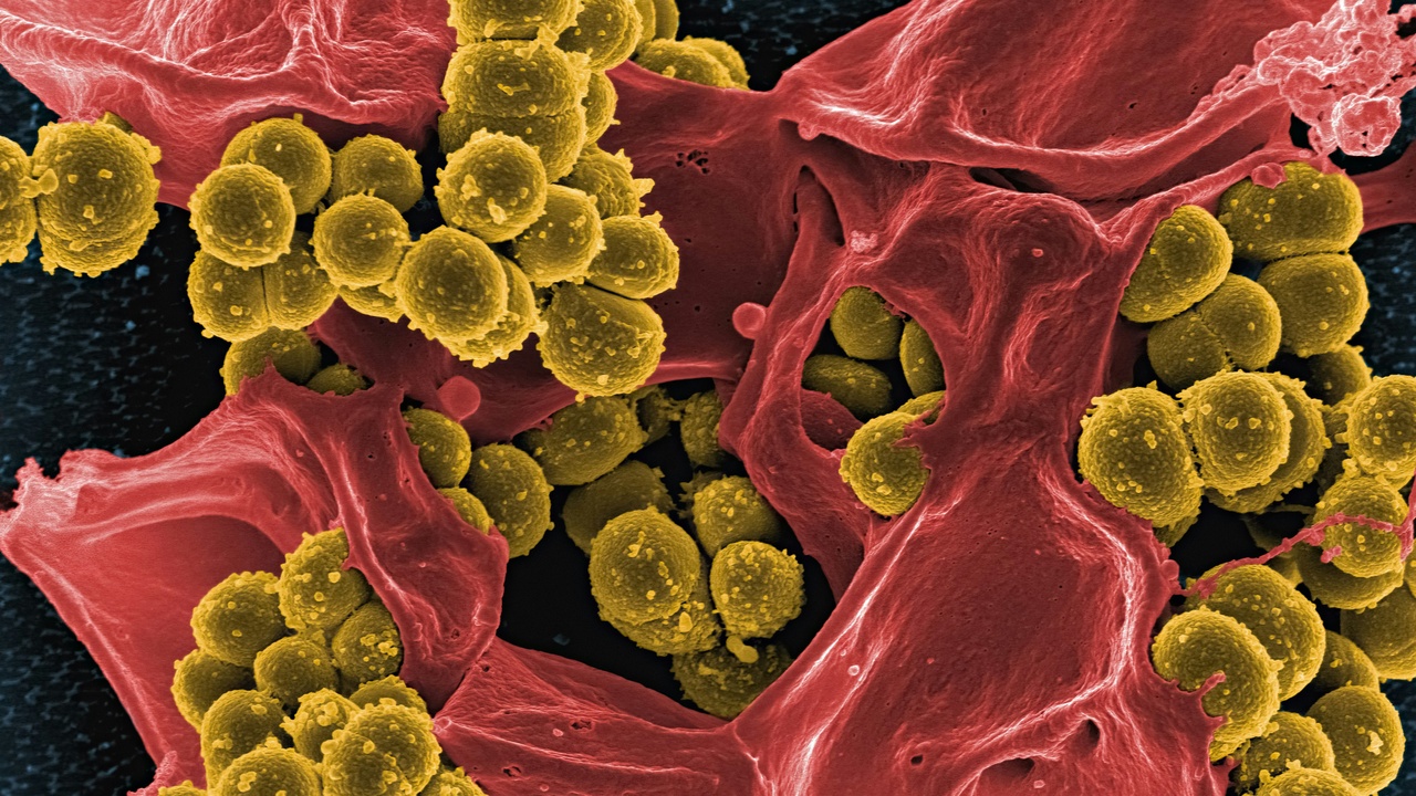 Close-up of bacteria cultured to show antibiotic-resistant colonies.