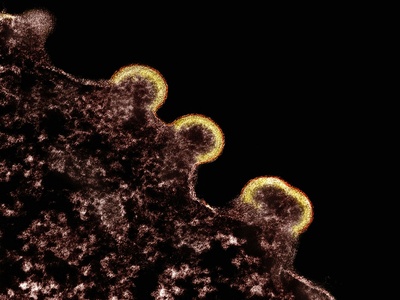 Salmonella enterica serovar Typhi