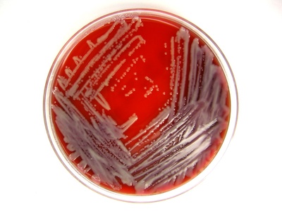 Stenotrophomonas maltophilia
