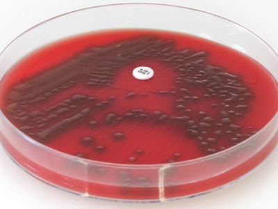 Streptococcus pneumoniae