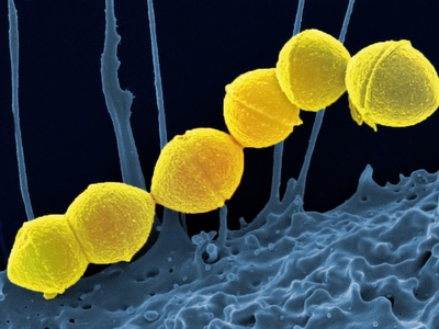 Streptococcus pyogenes (Group A Strep)