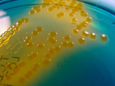Vibrio cholerae