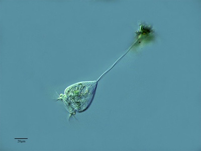 Vorticella