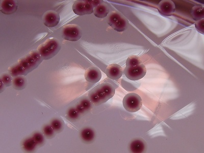 Yersinia enterocolitica