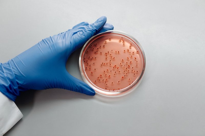 A scientist with blue gloves examines a bacterial culture in a petri dish in a laboratory setting.
