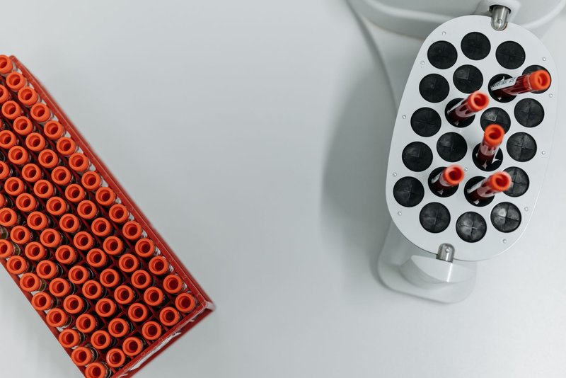 Top view of blood sample tubes in a laboratory centrifuge, essential for medical research.
